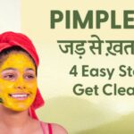 Face Blemishes Home Remedies