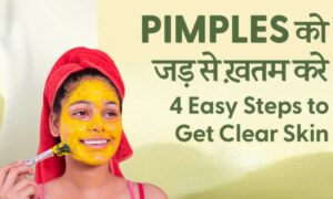 Face Blemishes Home Remedies: सिर्फ 100 रुपये में चेहरे से हटाएं दाग-धब्बे, पाएं बेदाग निखरी त्वचा