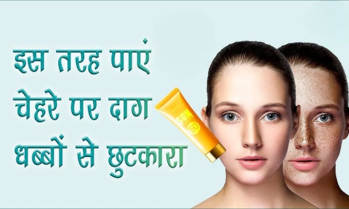Face Blemishes Home Remedies